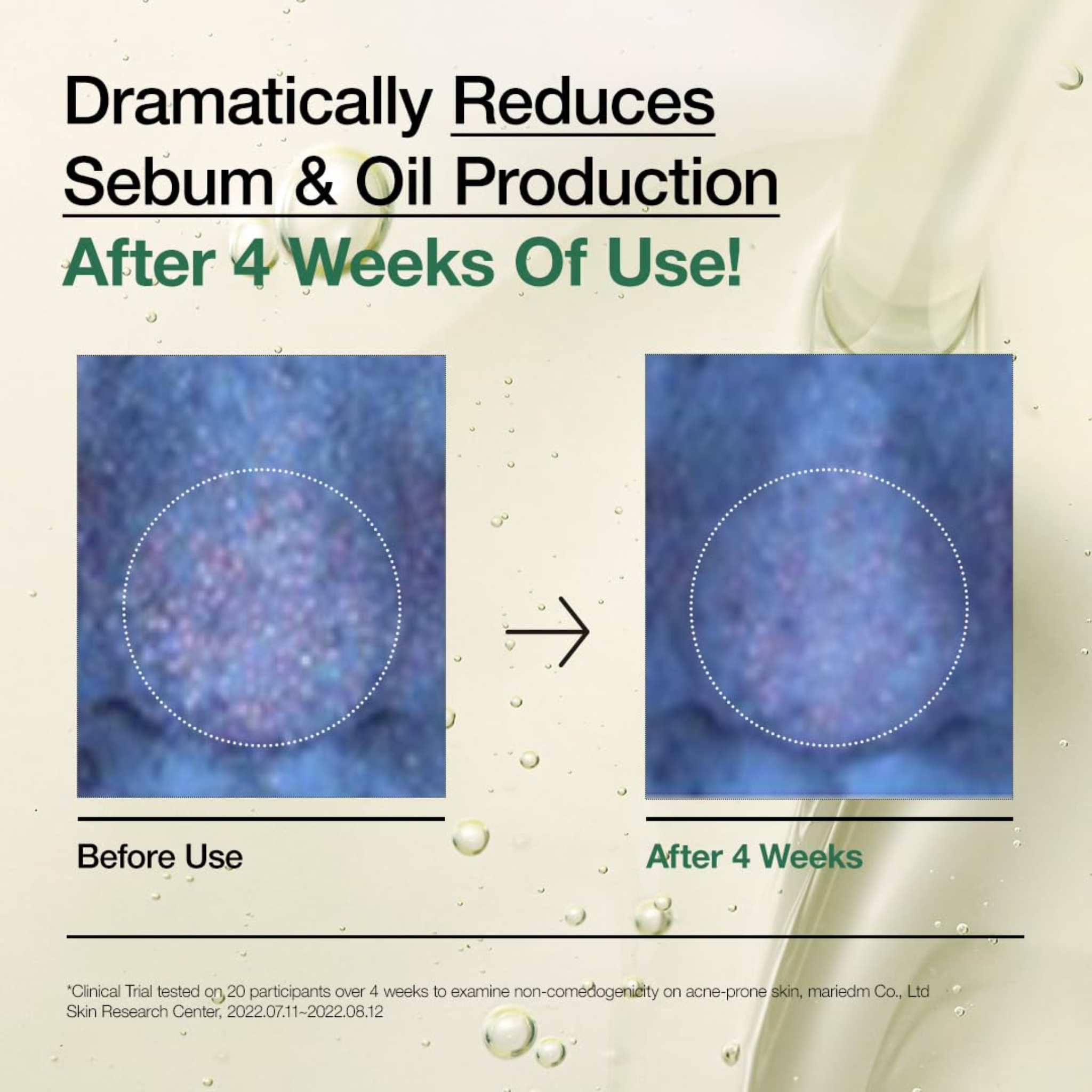 Anua, Heartleaf Pore Control Cleansing Oil , 6.67 fl oz (200 ml)