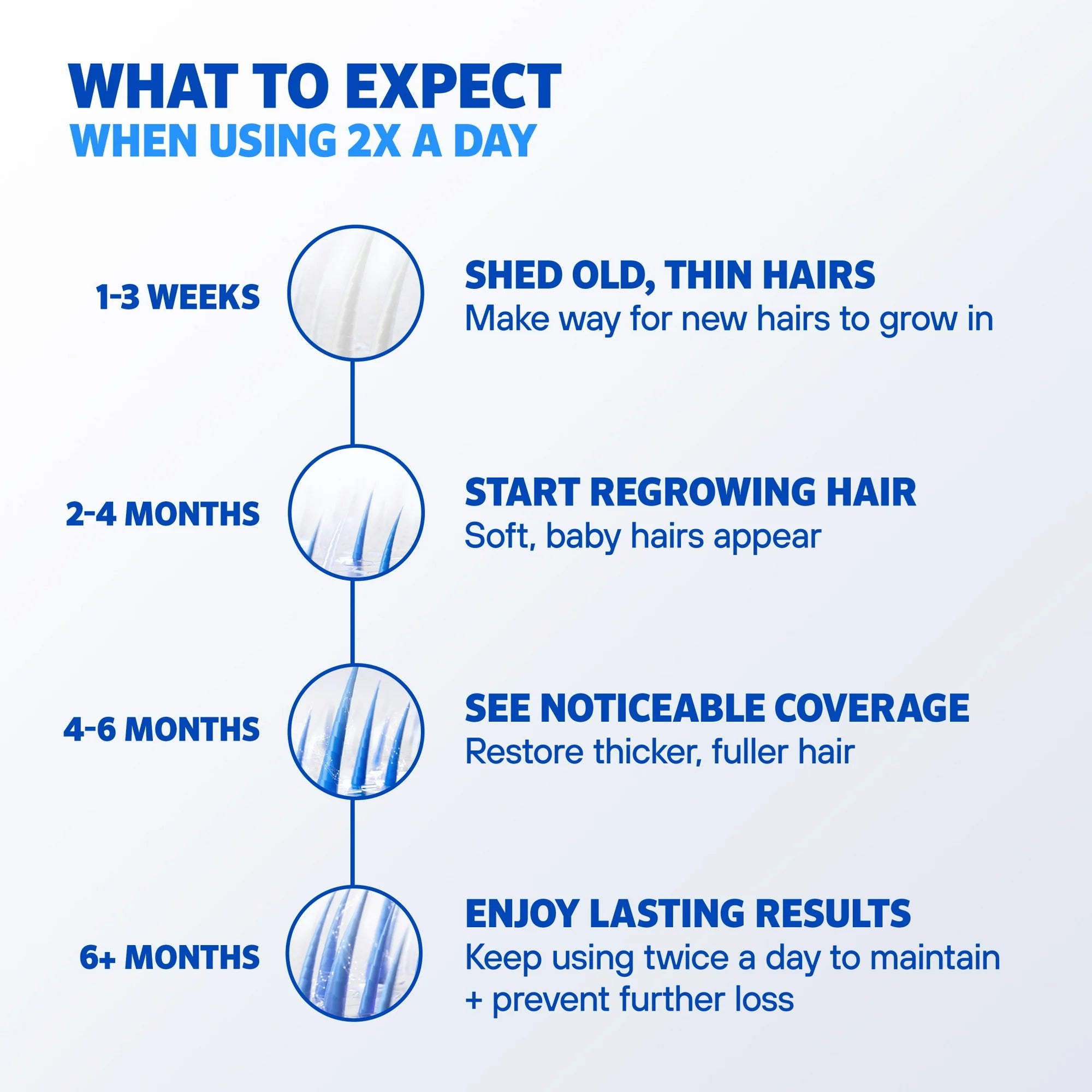 Rogaine Mens' 5% Minoxidil Foam for Hair Regrowth - 6.33oz 3-Mo Supply